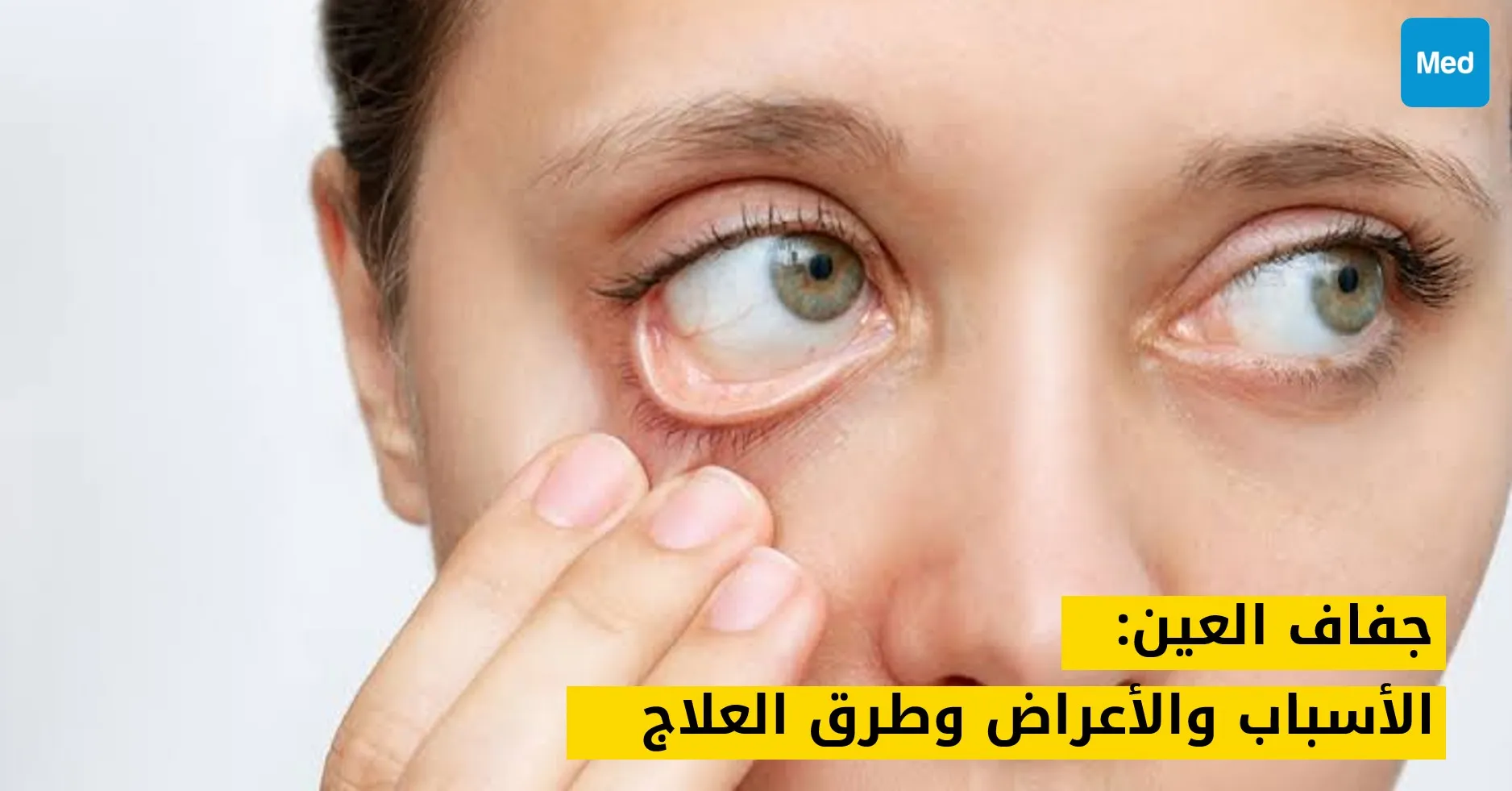 جفاف العين: الأسباب والأعراض وطرق العلاج
